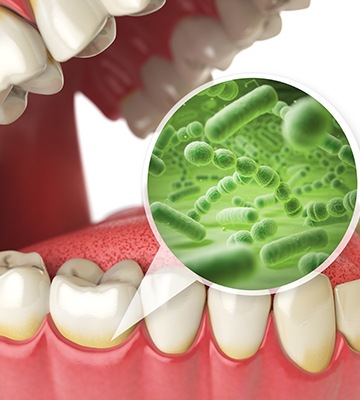 closeup of smile and oral bacteria animation