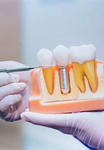 Dentist pointing to a dental implant model